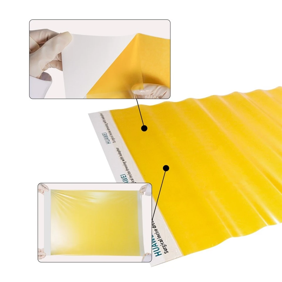 Raucodrape Surgical Incise Drape price